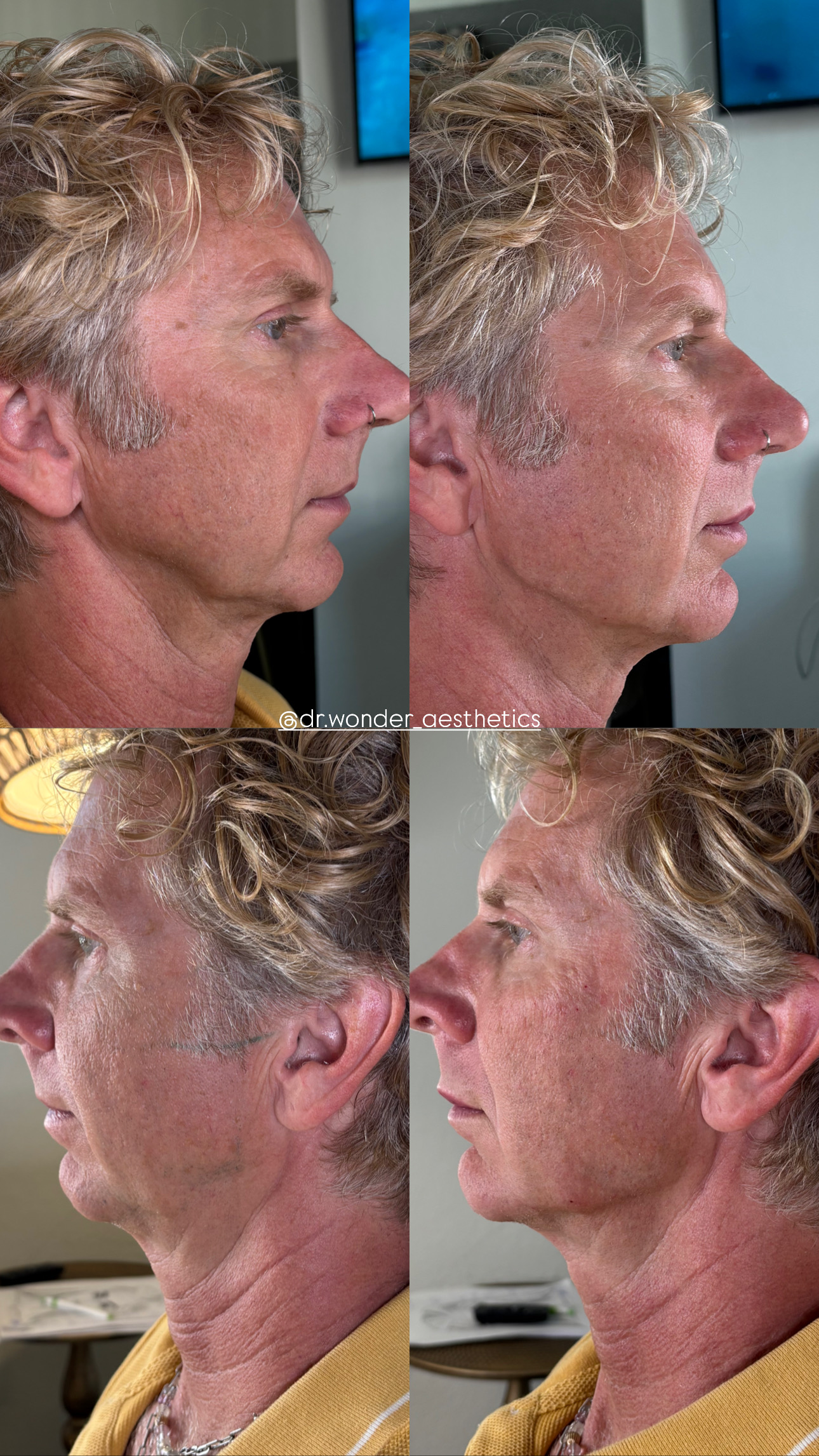 Client Before/After Result