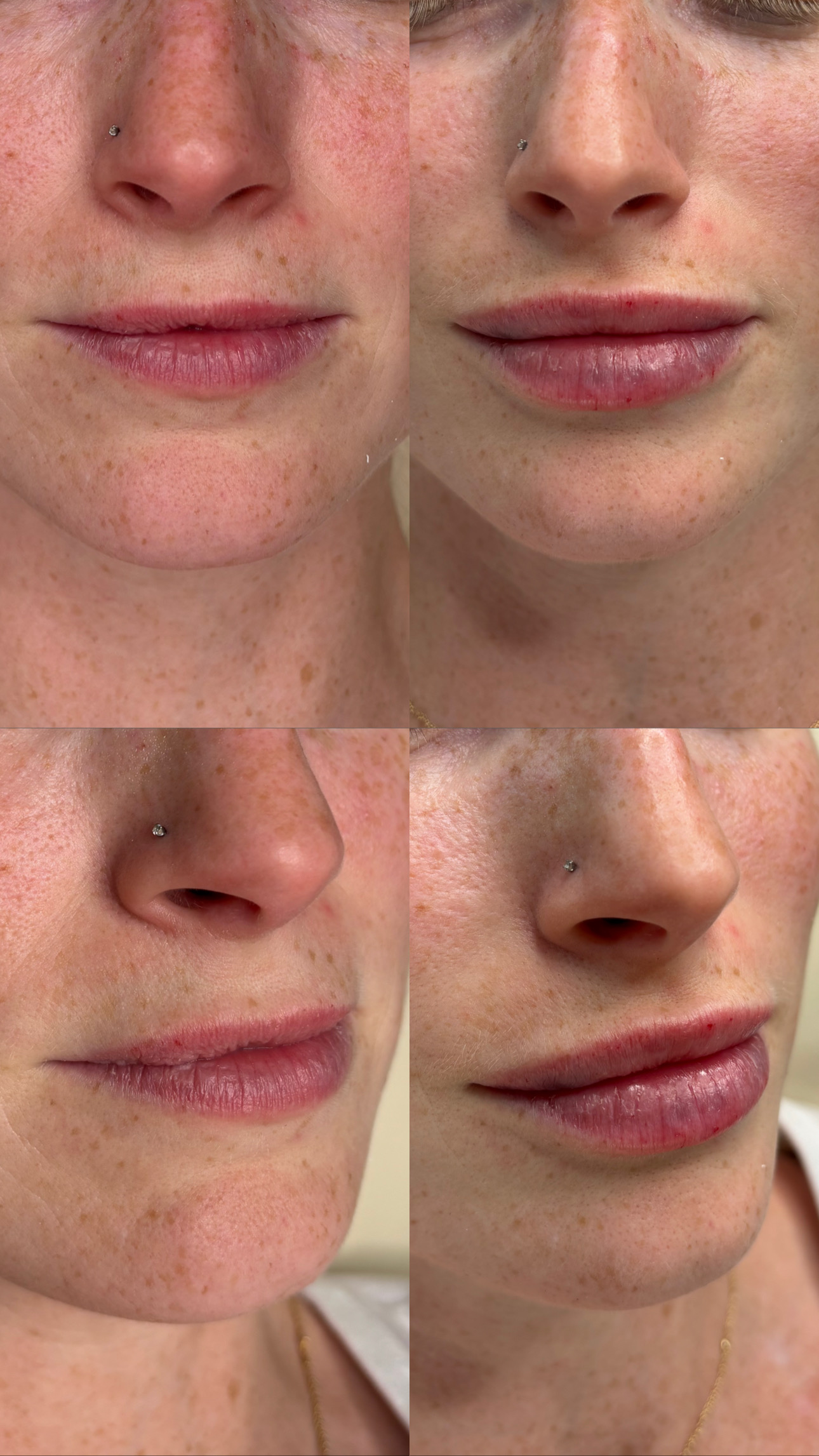 Client Before/After Result