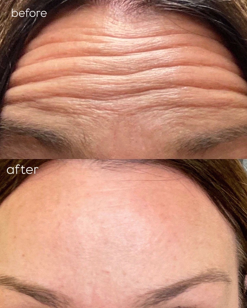 Client Before/After Result
