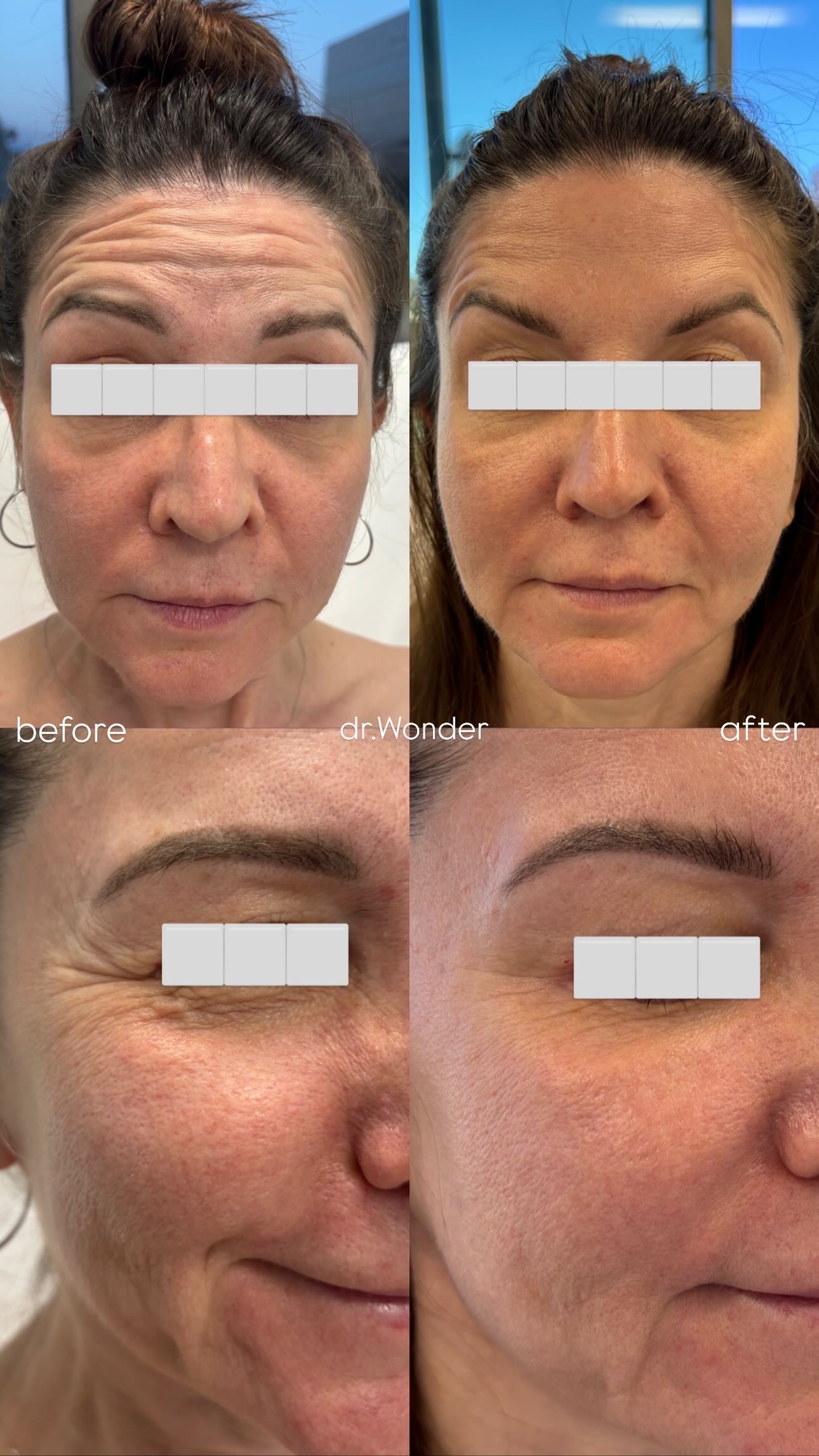 Client Before/After Result