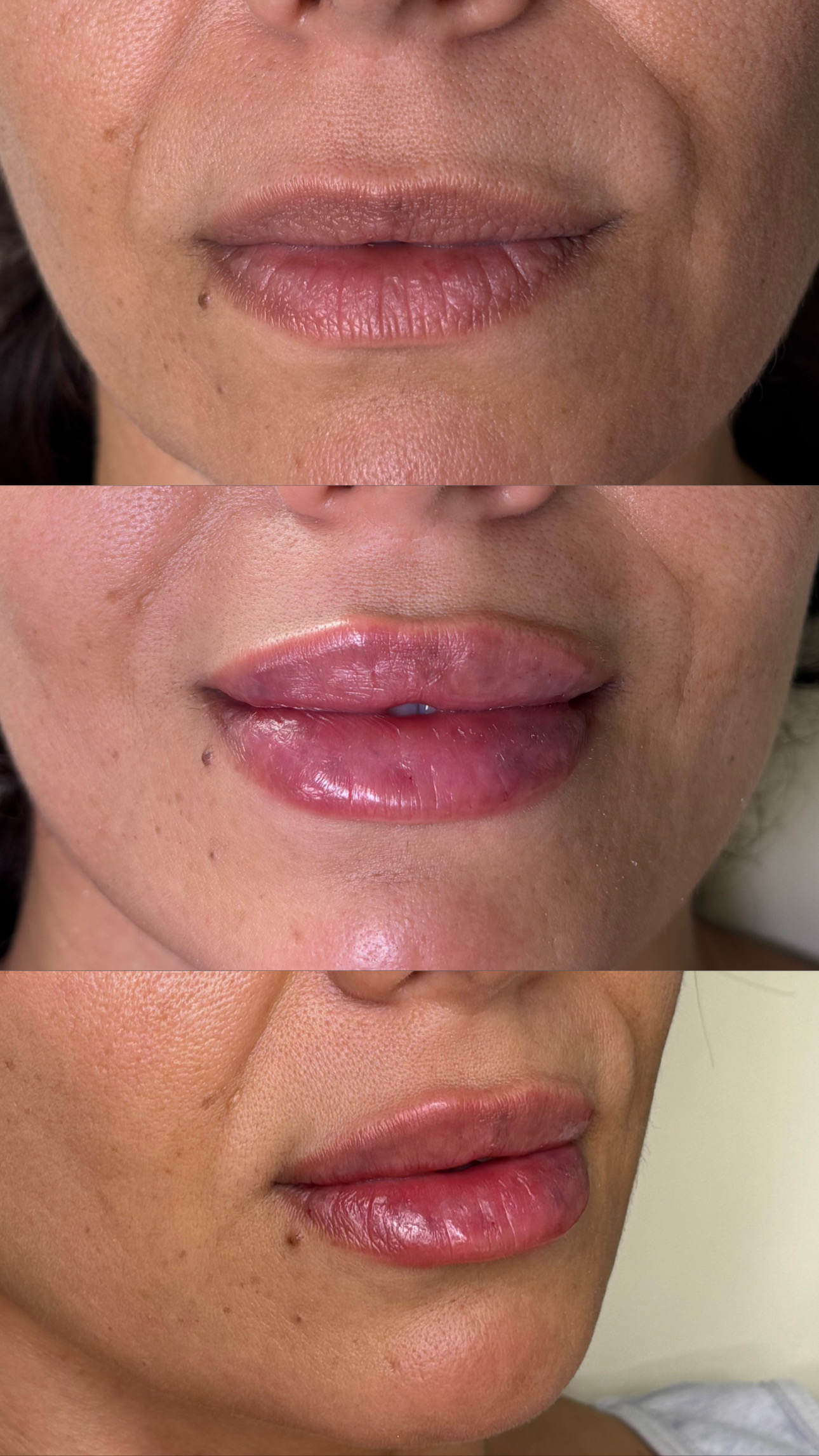 Client Before/After Result