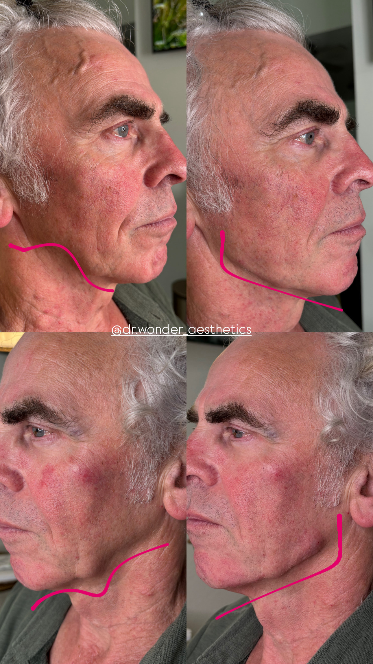 Client Before/After Result