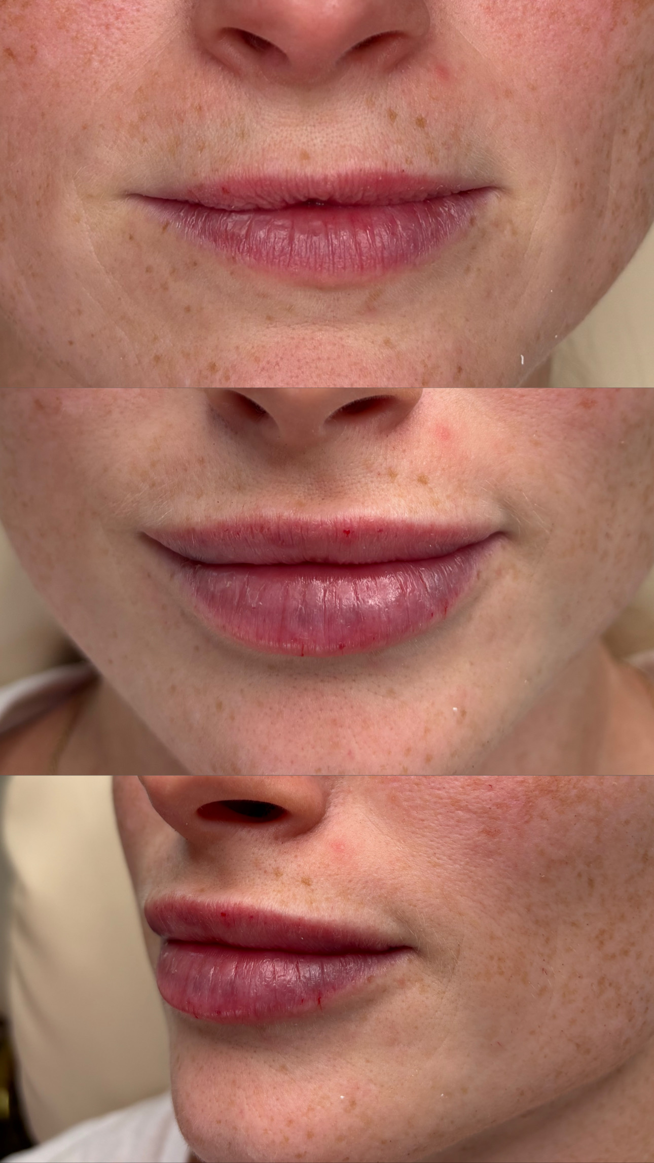 Client Before/After Result