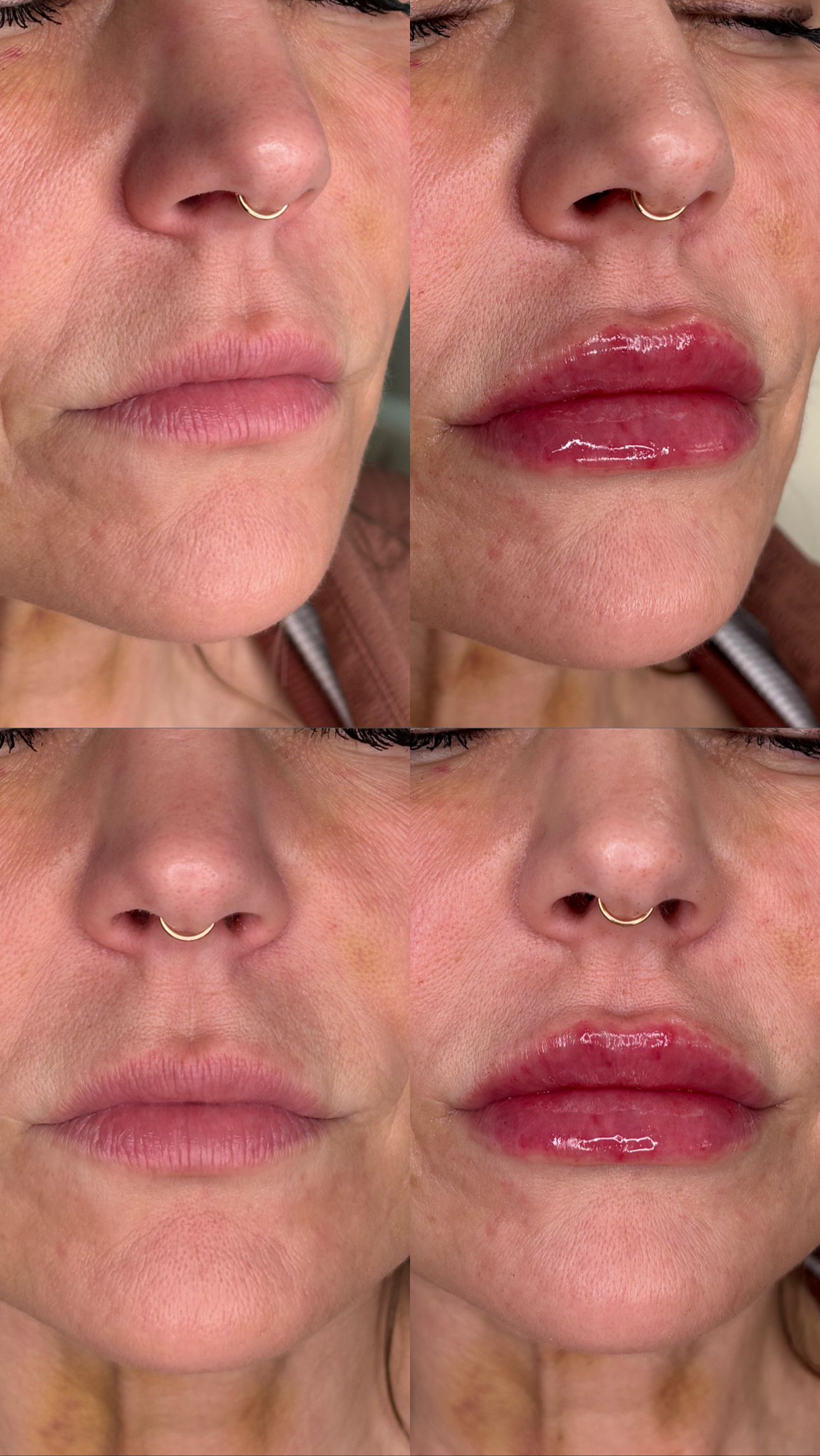 Client Before/After Result