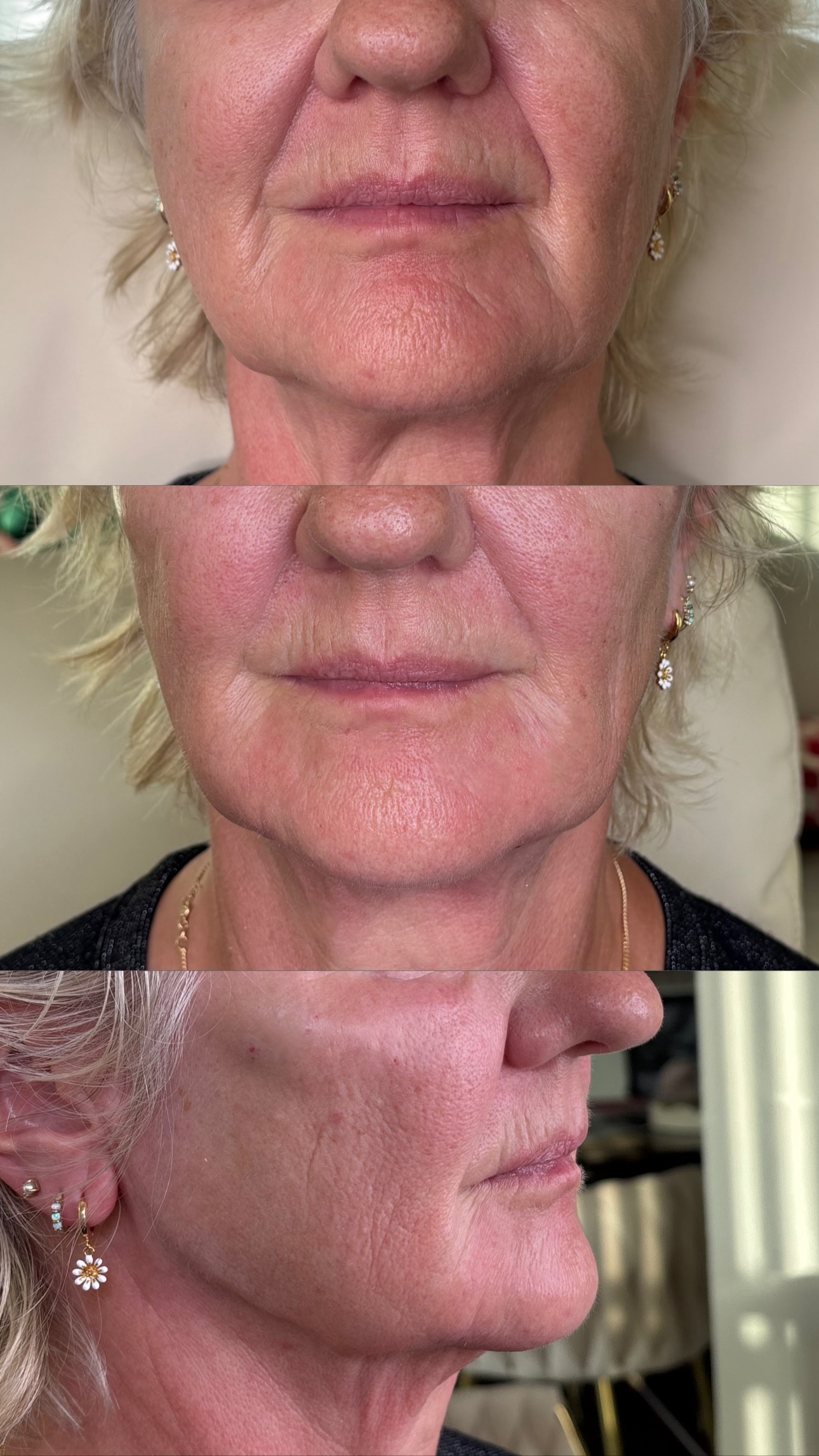 Client Before/After Result
