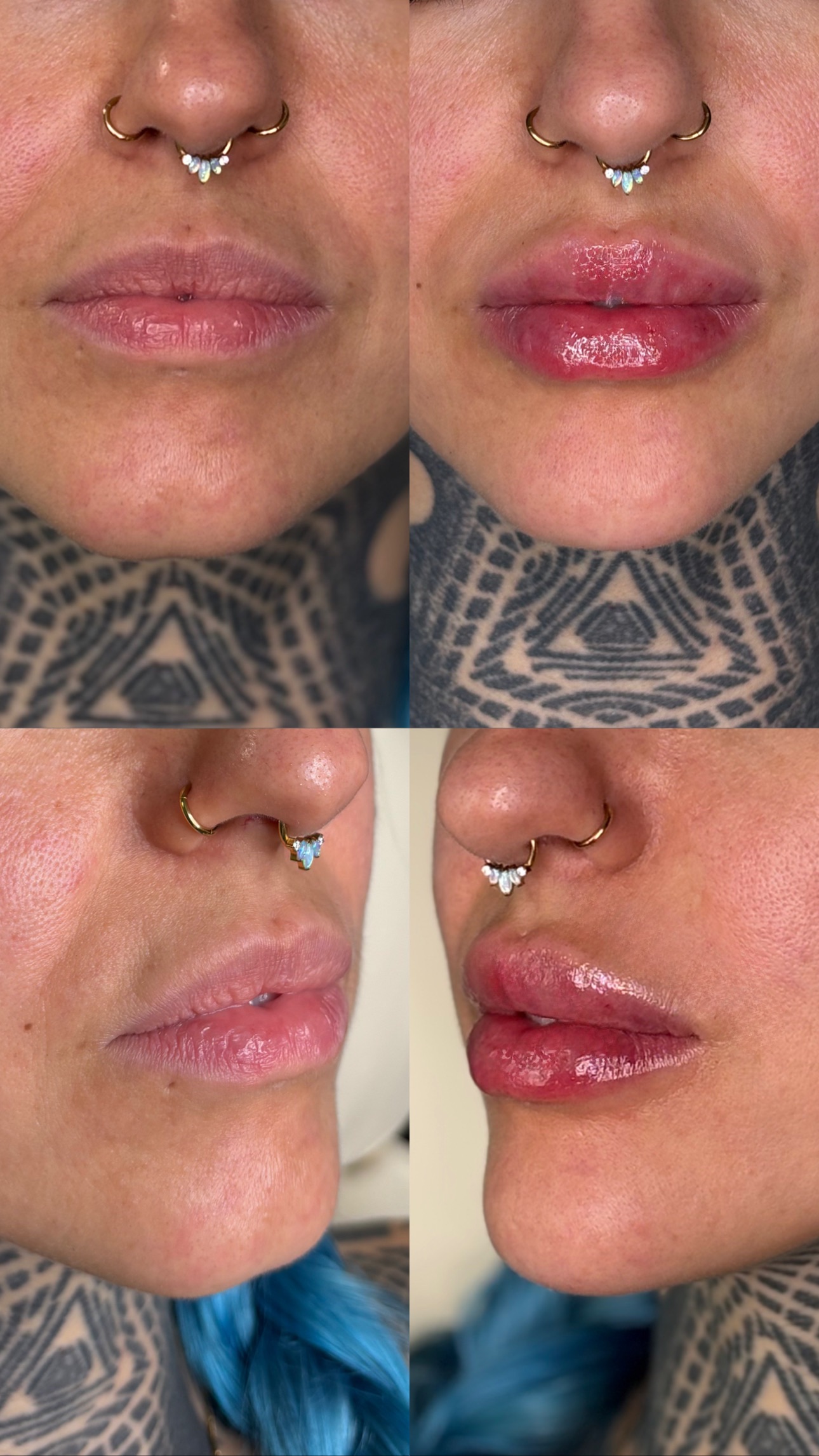 Client Before/After Result