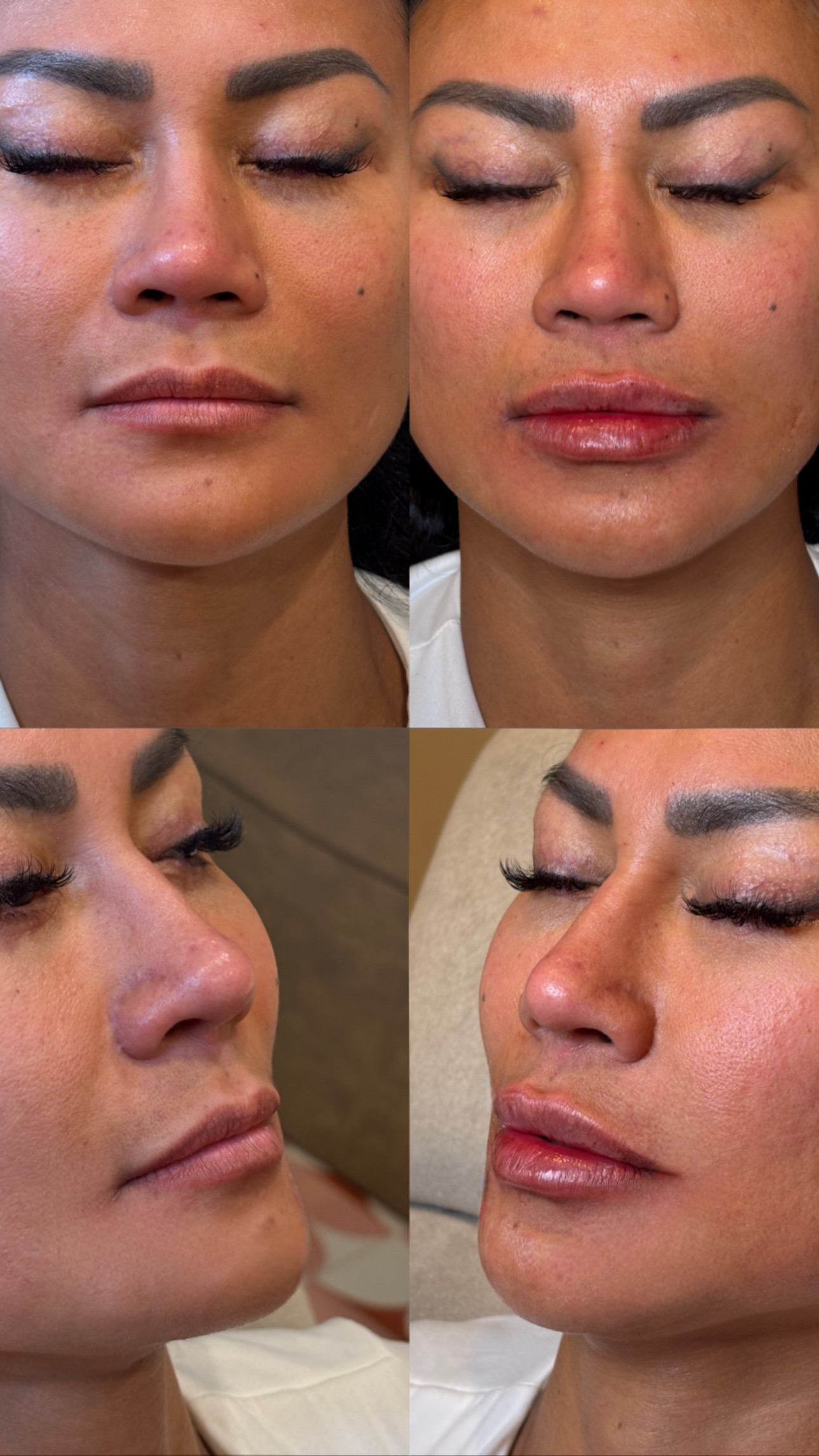 Client Before/After Result