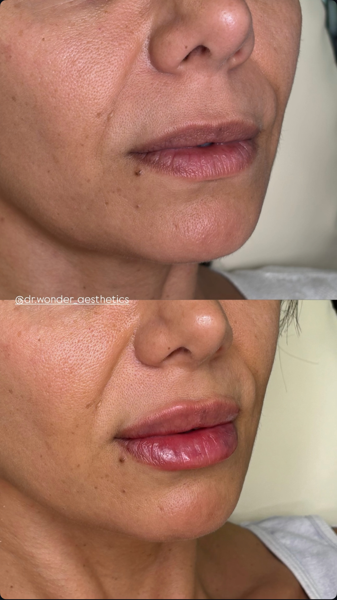 Client Before/After Result