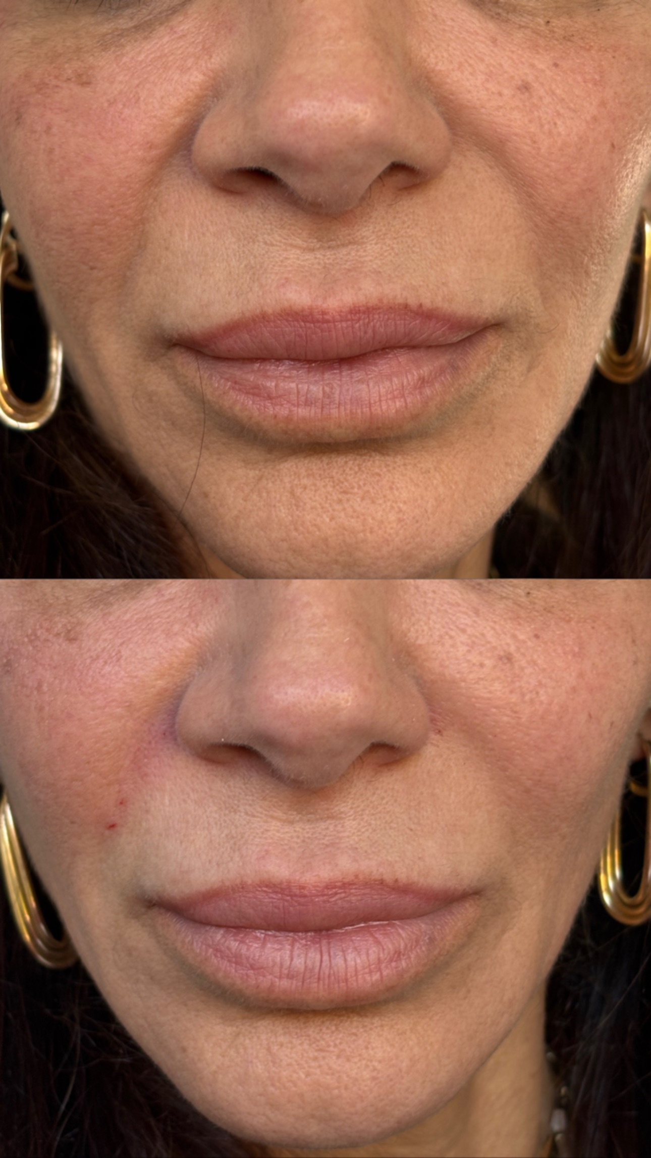 Client Before/After Result
