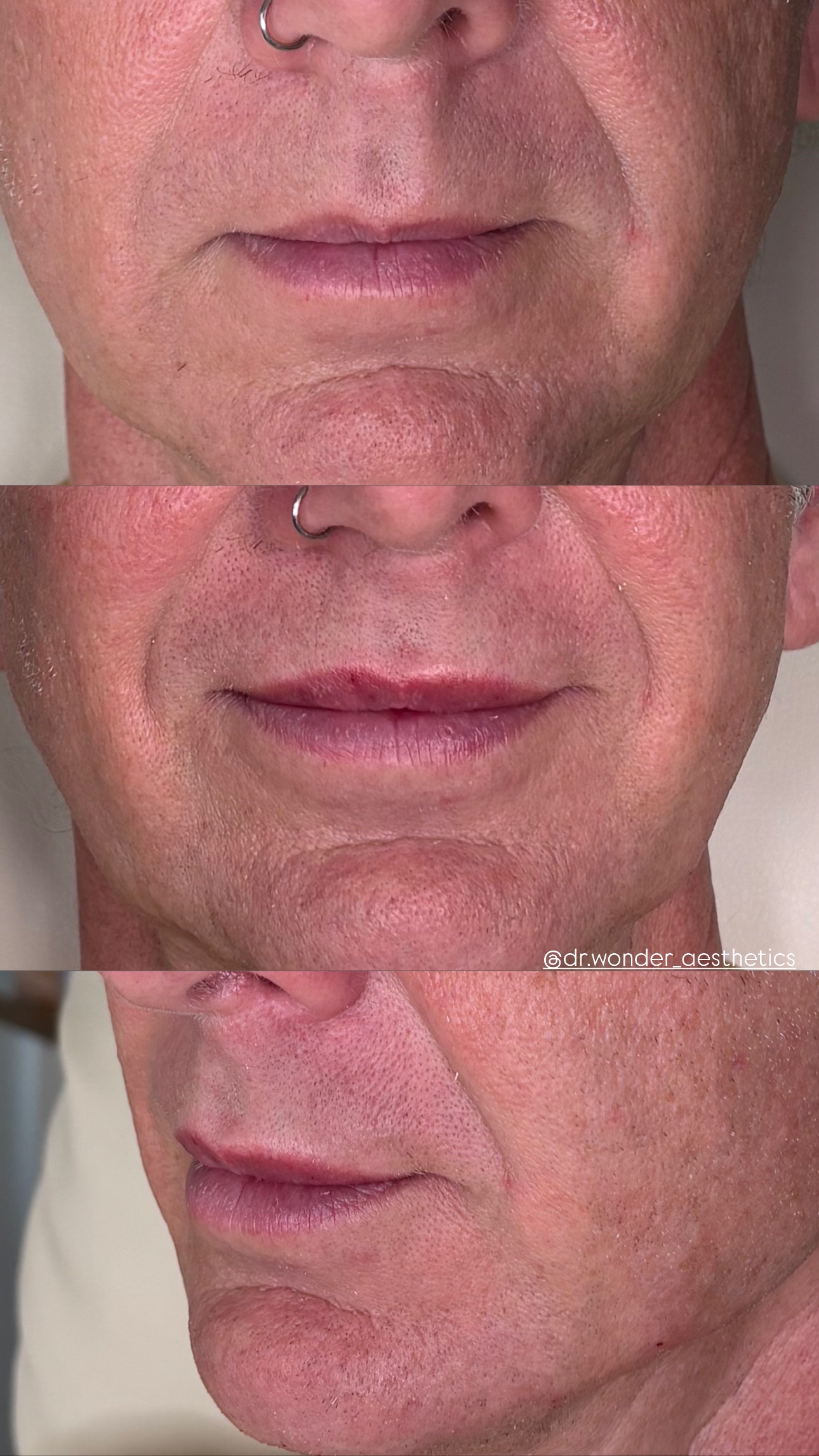 Client Before/After Result