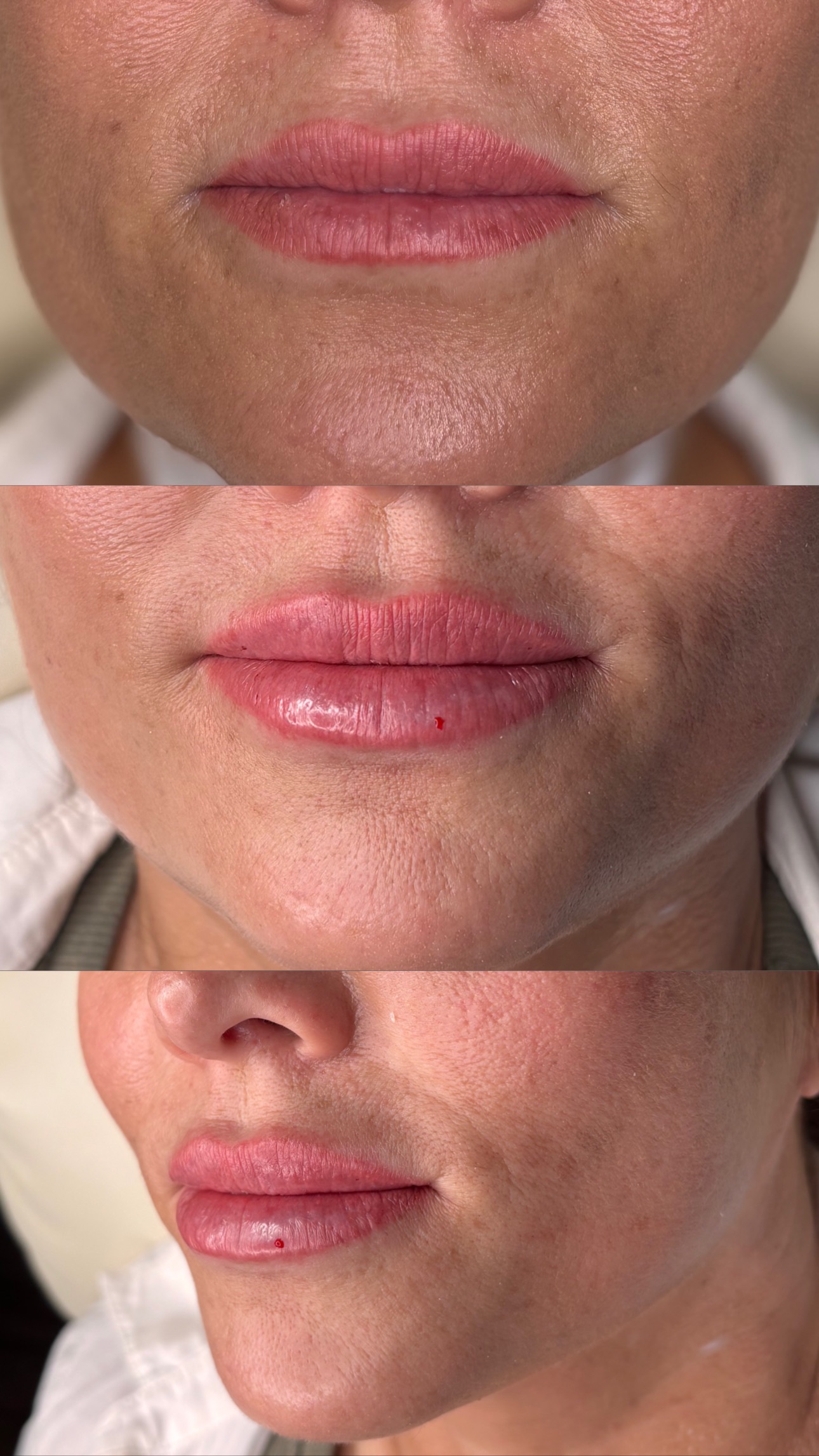 Client Before/After Result