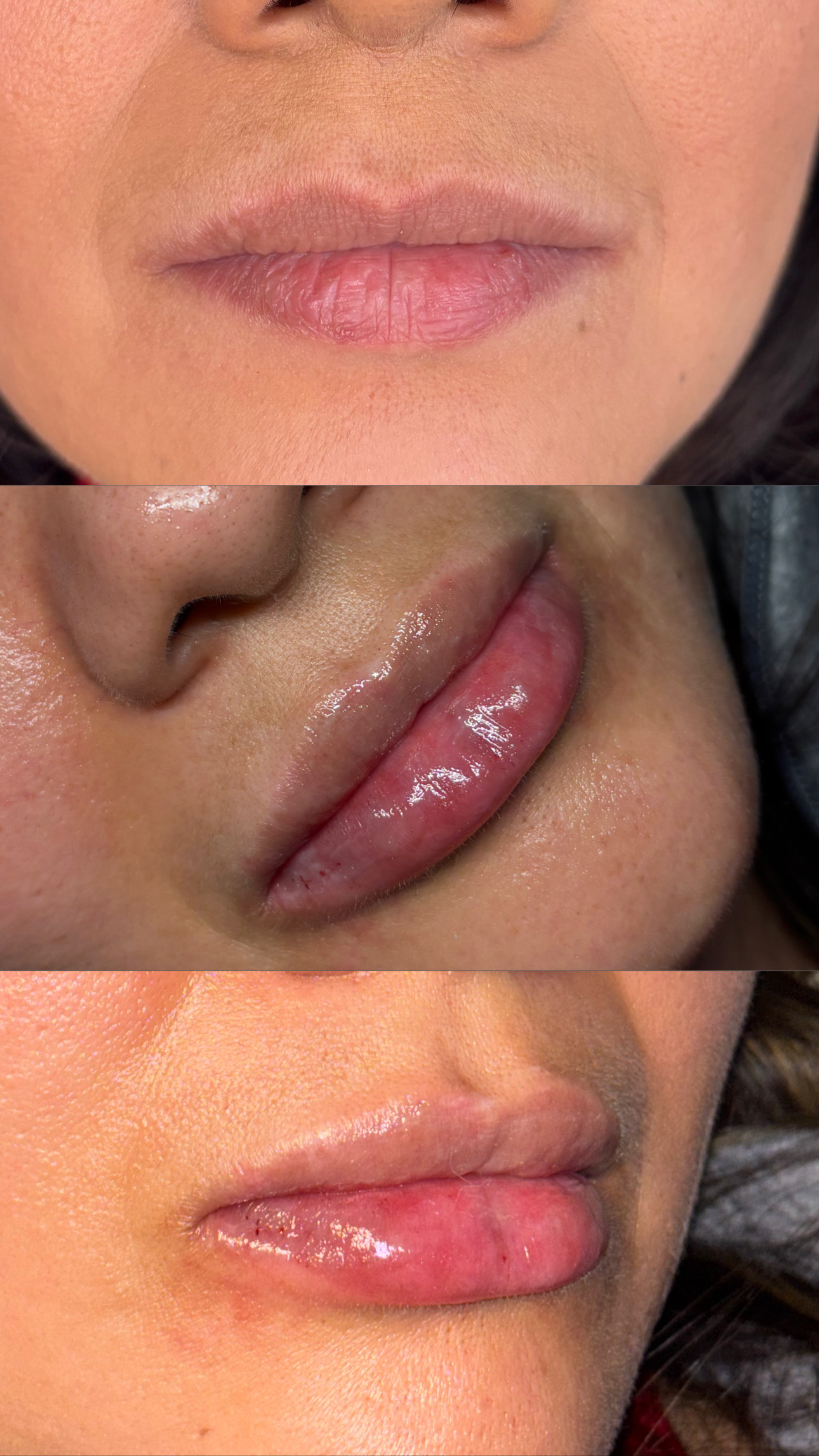Client Before/After Result