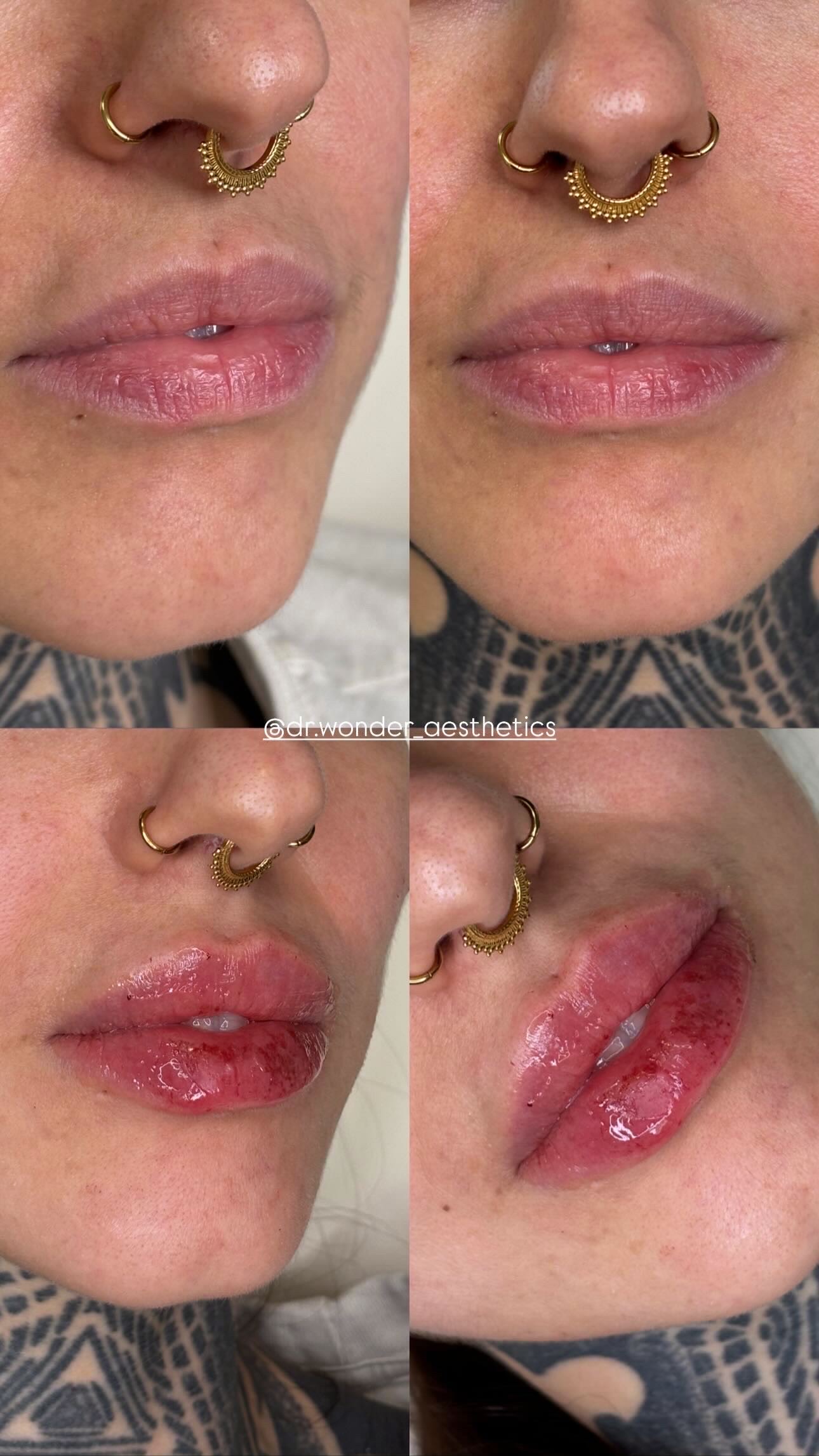 Client Before/After Result