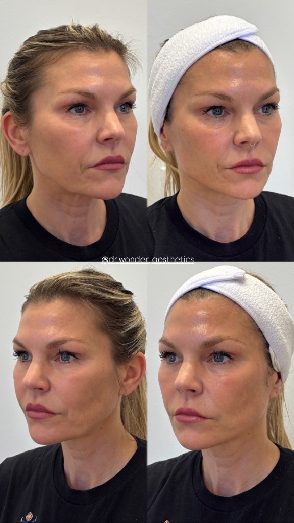 Client Before/After Result