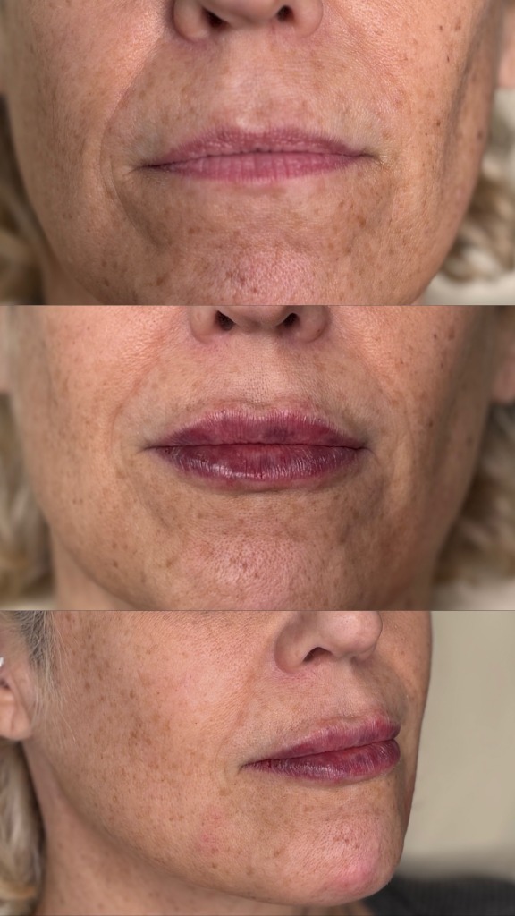Client Before/After Result