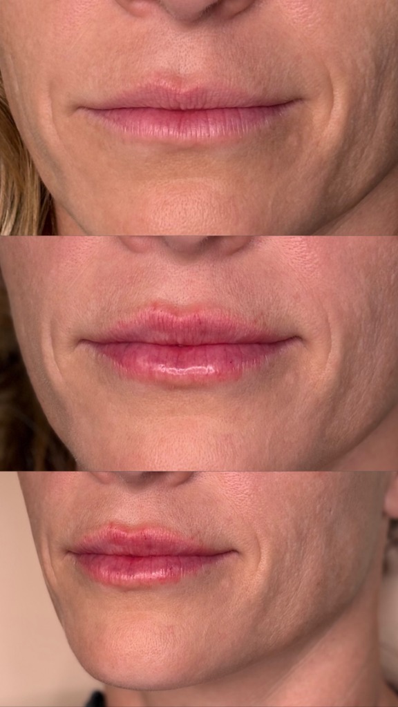 Client Before/After Result