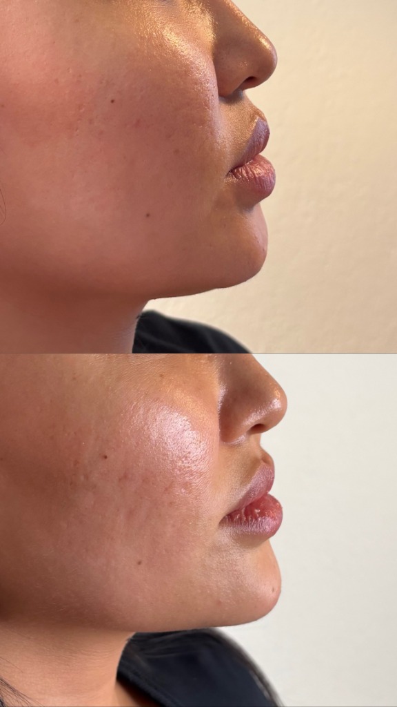 Client Before/After Result