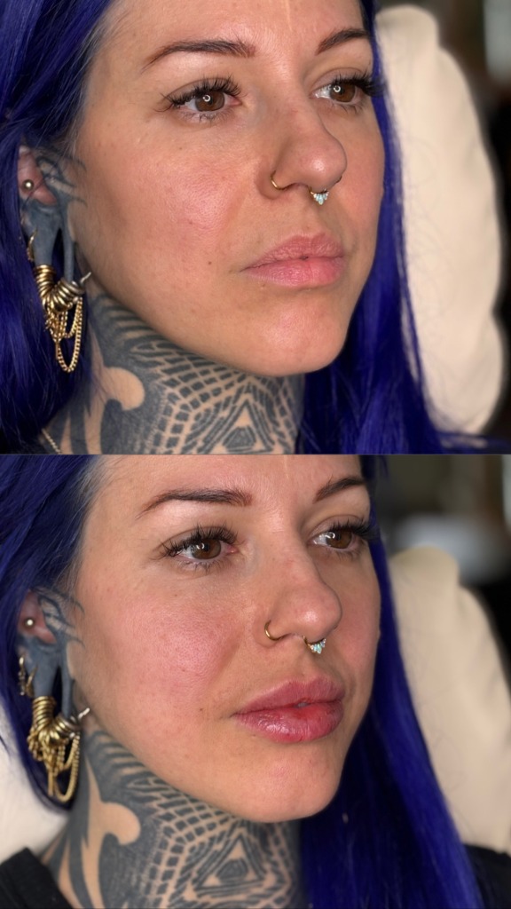 Client Before/After Result