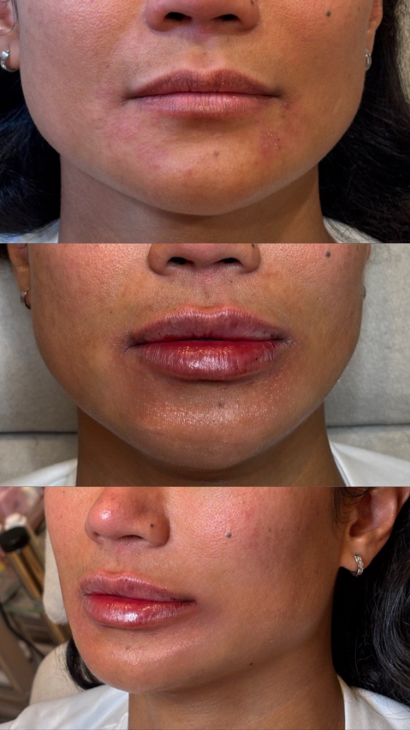 Client Before/After Result